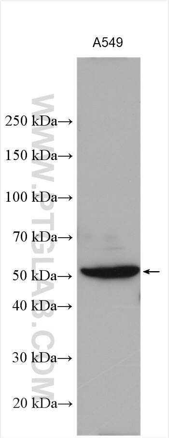 DFNA5 Antibody in Western Blot (WB)