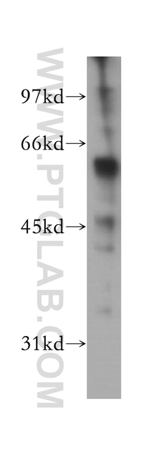 DFNA5 Antibody in Western Blot (WB)