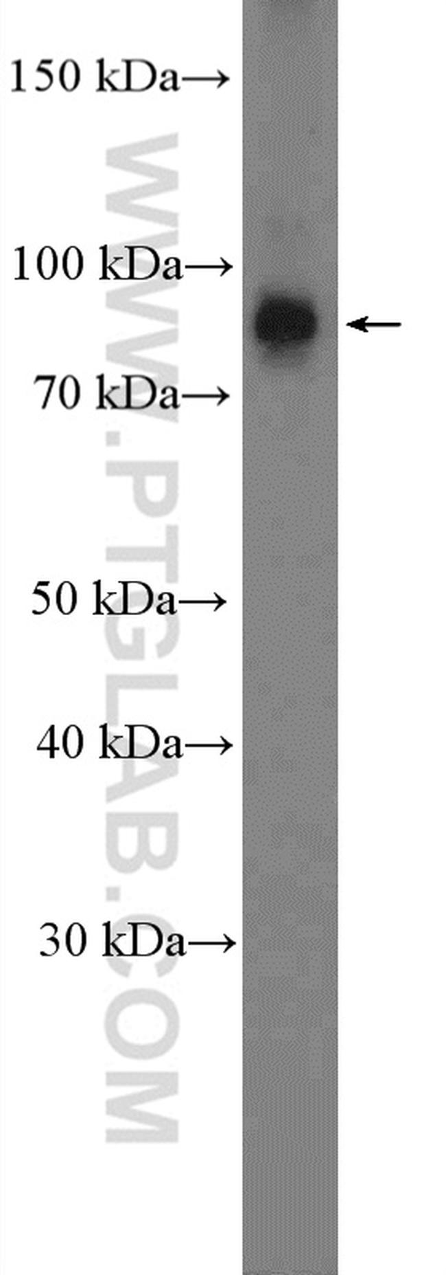 NUP93 Antibody in Western Blot (WB)