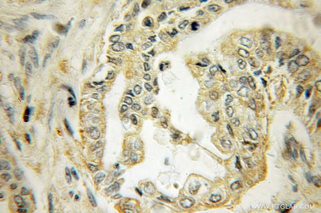 CTNS Antibody in Immunohistochemistry (Paraffin) (IHC (P))