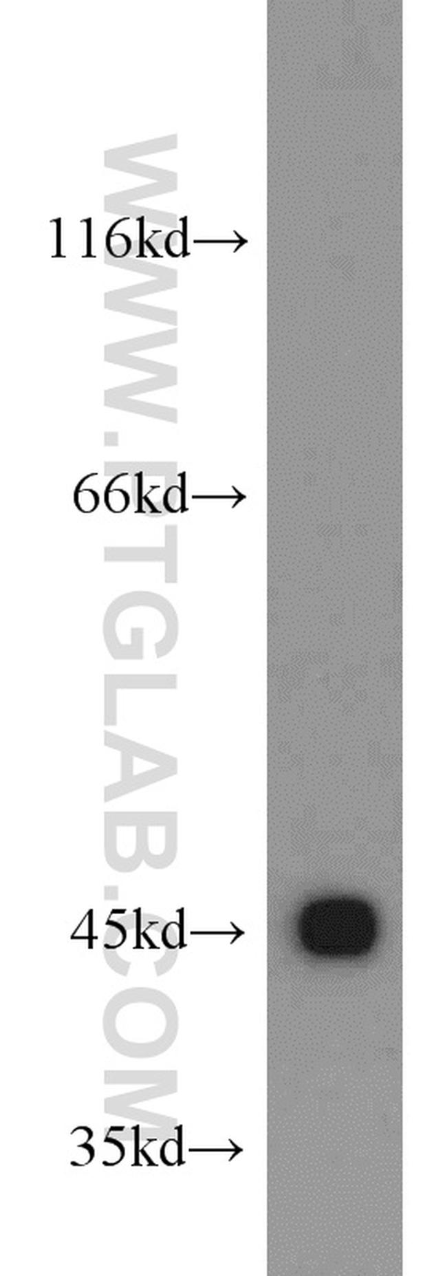 CTNS Antibody in Western Blot (WB)