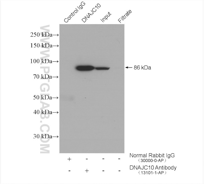 DNAJC10 Antibody in Immunoprecipitation (IP)