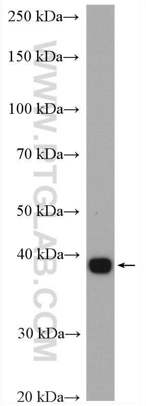 ACADSB Antibody in Western Blot (WB)