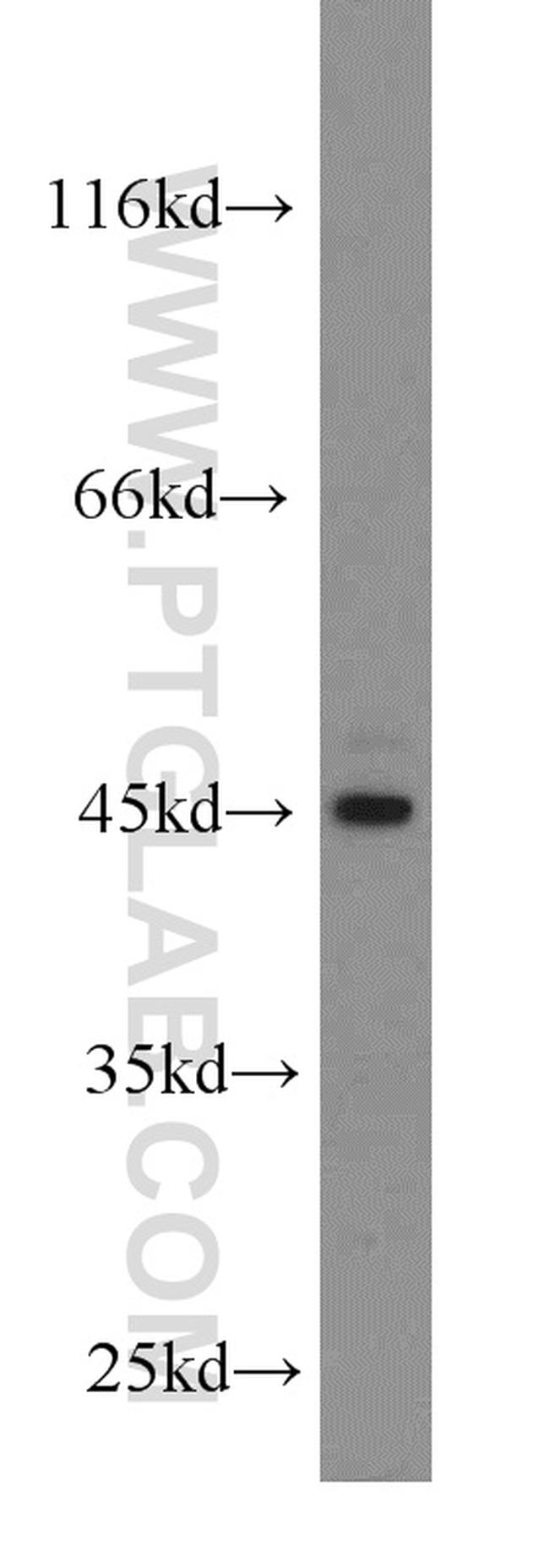 ACADSB Antibody in Western Blot (WB)