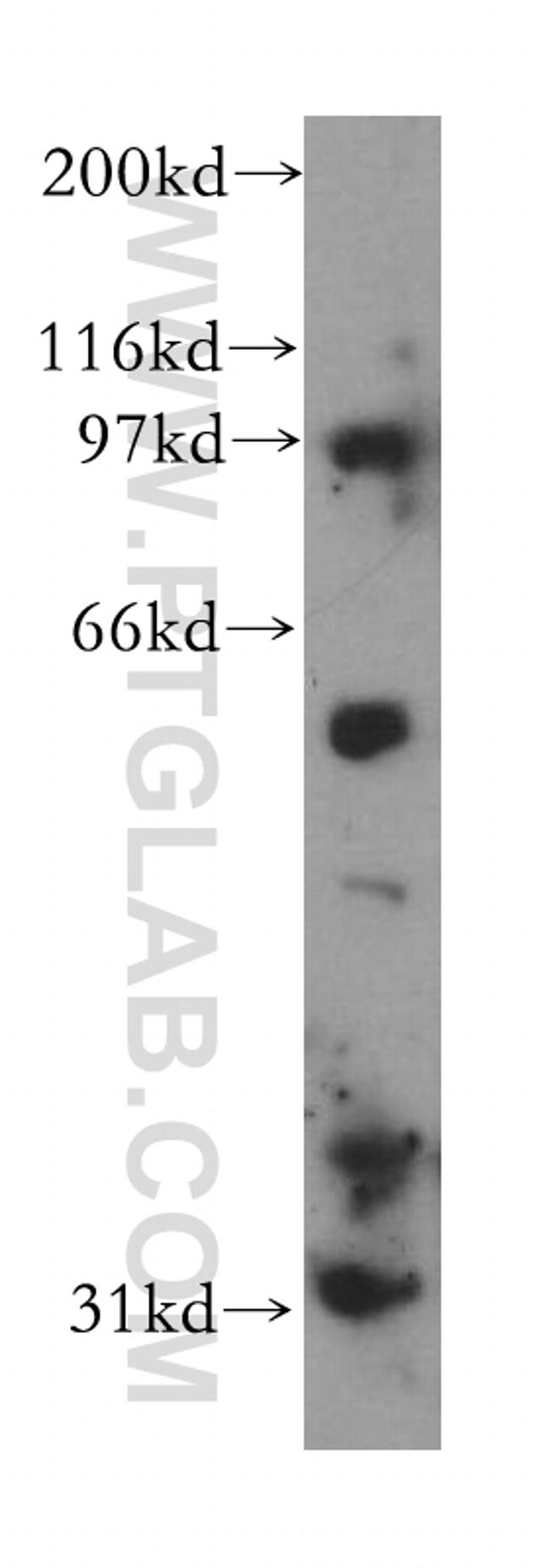 CHST9 Antibody in Western Blot (WB)