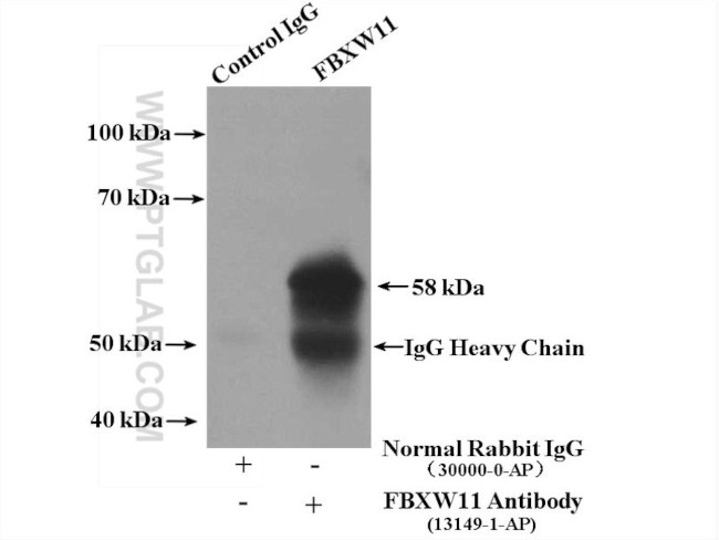 FBXW11 Antibody in Immunoprecipitation (IP)