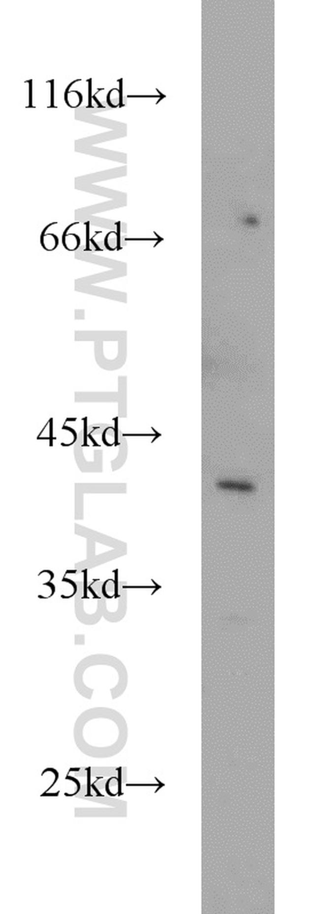 GYG2 Antibody in Western Blot (WB)