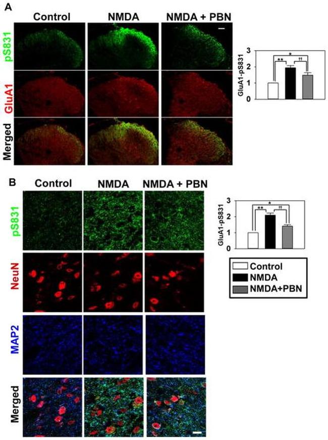 MAP2 Antibody in Immunohistochemistry (IHC)