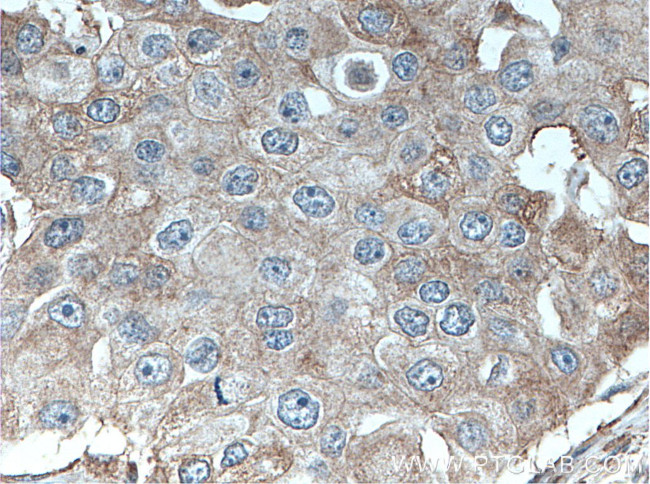 DNAJB9 Antibody in Immunohistochemistry (Paraffin) (IHC (P))
