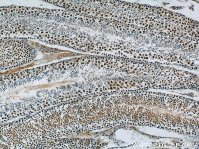 SIRT1 Antibody in Immunohistochemistry (Paraffin) (IHC (P))