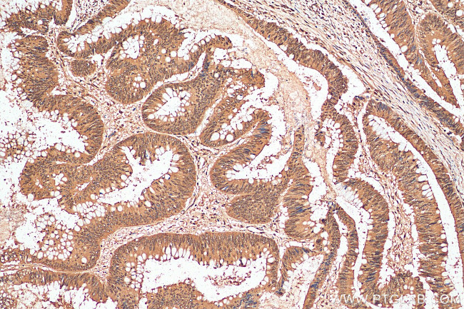 SIRT1 Antibody in Immunohistochemistry (Paraffin) (IHC (P))