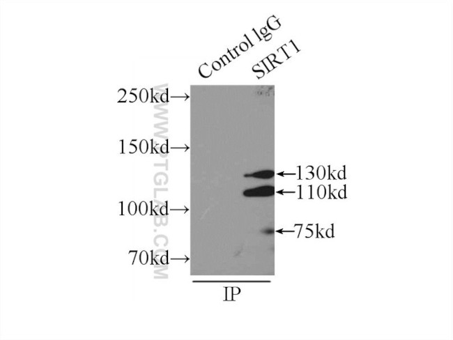 SIRT1 Antibody in Immunoprecipitation (IP)