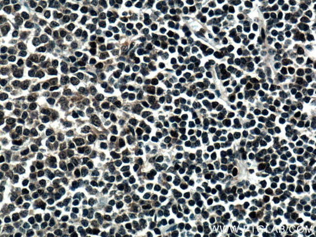 DNAJB1 Antibody in Immunohistochemistry (Paraffin) (IHC (P))