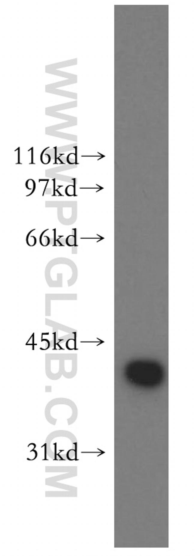 DNAJB1 Antibody in Western Blot (WB)