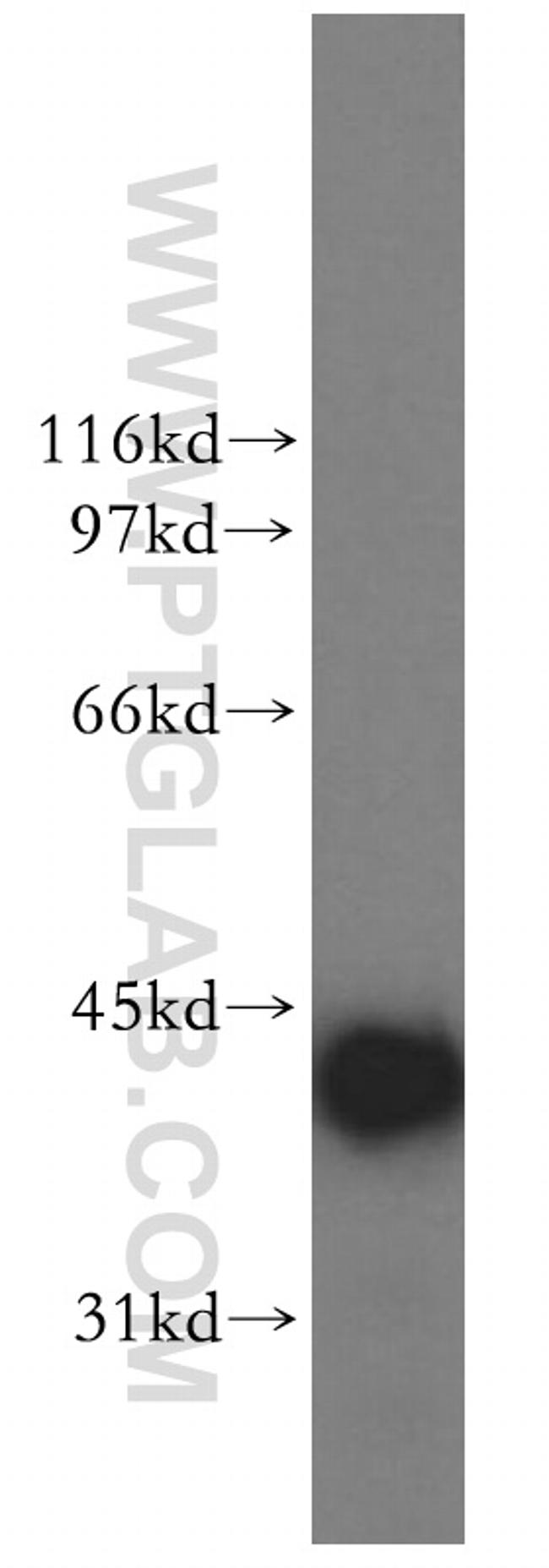 DNAJB1 Antibody in Western Blot (WB)