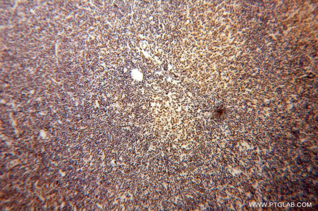 DNAJB1 Antibody in Immunohistochemistry (Paraffin) (IHC (P))