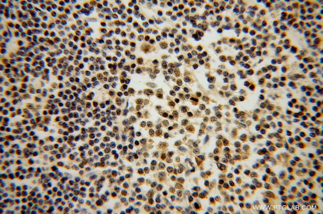 DNAJB1 Antibody in Immunohistochemistry (Paraffin) (IHC (P))