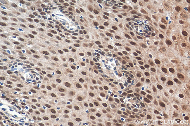 DNAJB1 Antibody in Immunohistochemistry (Paraffin) (IHC (P))