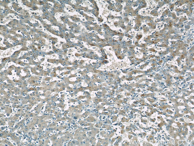 SAA2 Antibody in Immunohistochemistry (Paraffin) (IHC (P))