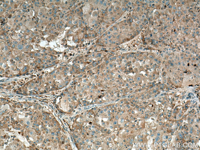 ISCA2 Antibody in Immunohistochemistry (Paraffin) (IHC (P))