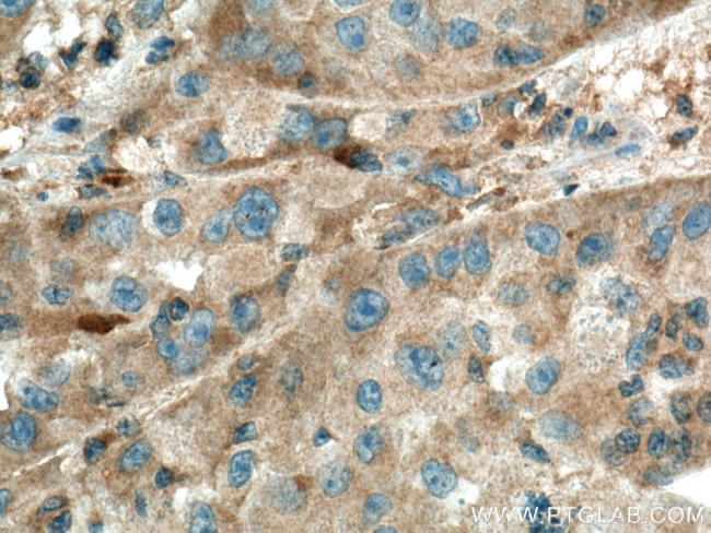 ISCA2 Antibody in Immunohistochemistry (Paraffin) (IHC (P))