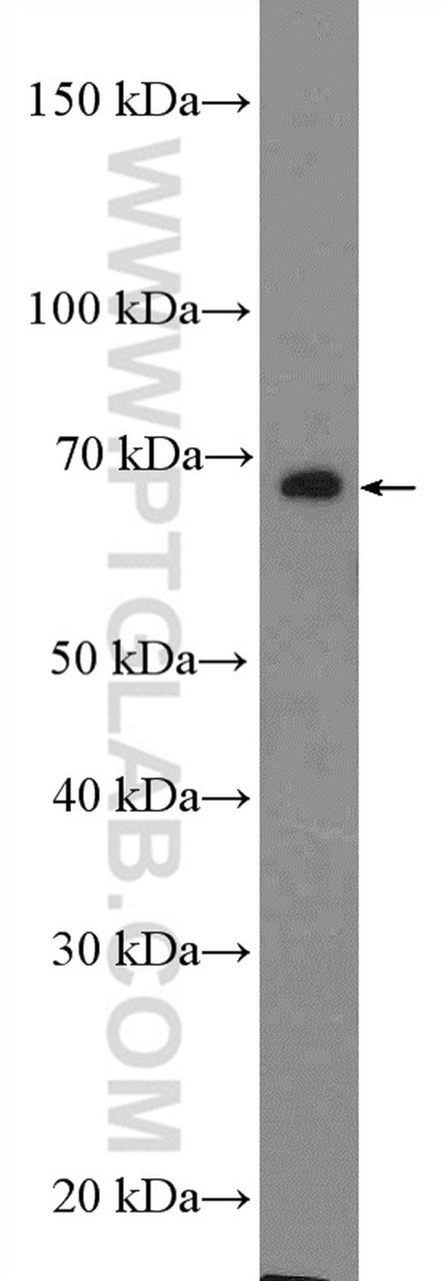 DCLRE1B Antibody in Western Blot (WB)