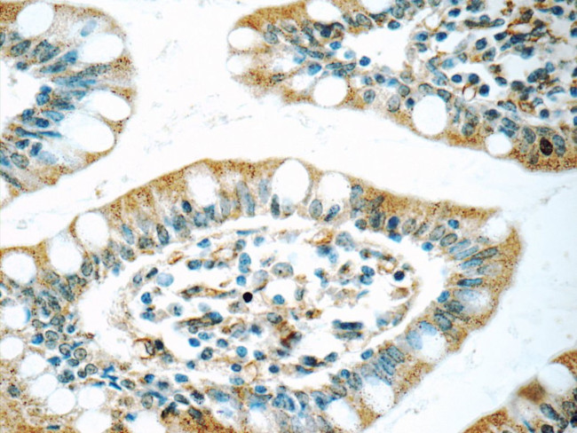 WFDC1 Antibody in Immunohistochemistry (Paraffin) (IHC (P))