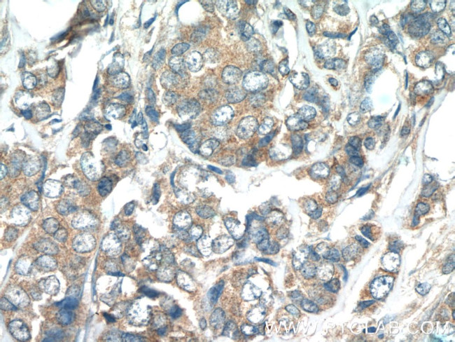 WFDC1 Antibody in Immunohistochemistry (Paraffin) (IHC (P))