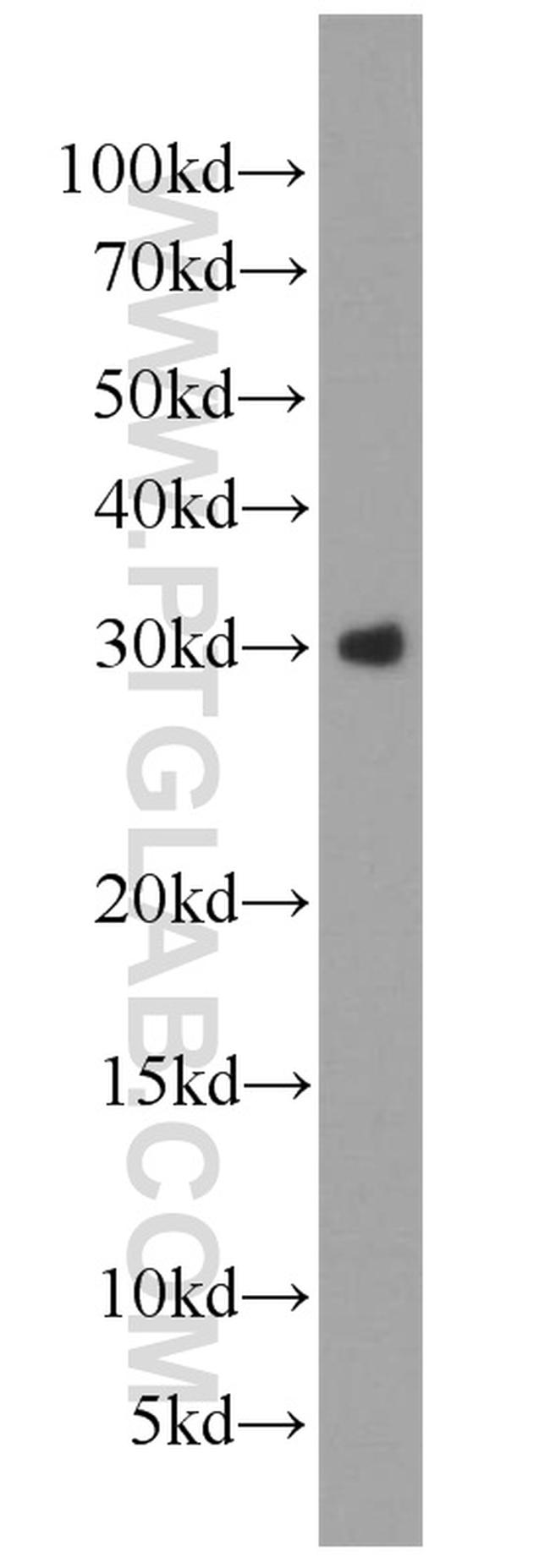 WFDC1 Antibody in Western Blot (WB)