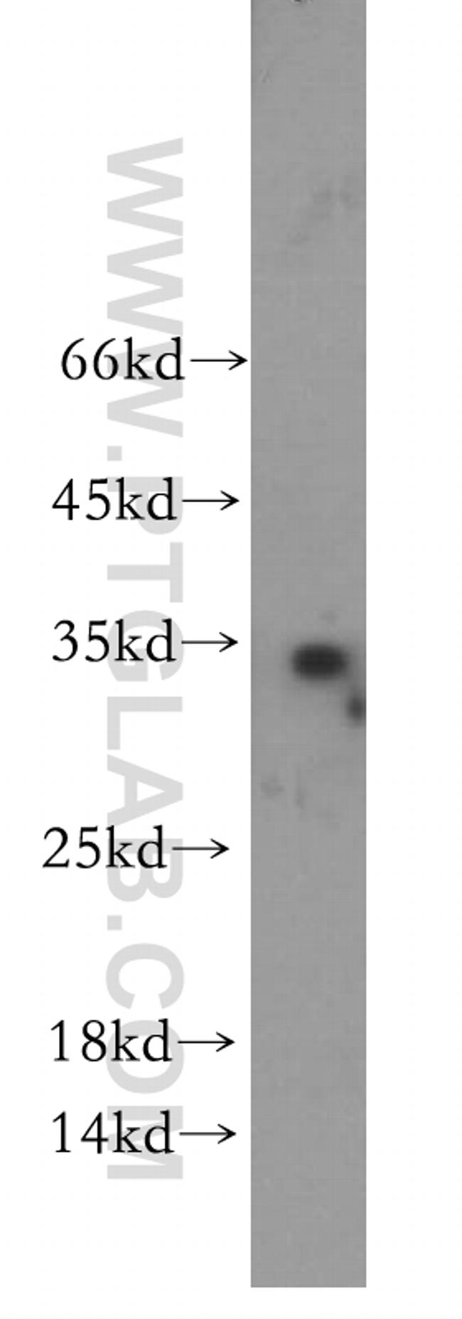 WFDC1 Antibody in Western Blot (WB)