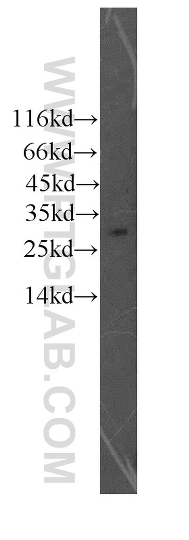 GZMM Antibody in Western Blot (WB)