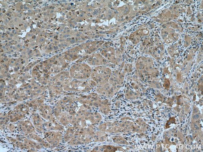 ARH Antibody in Immunohistochemistry (Paraffin) (IHC (P))