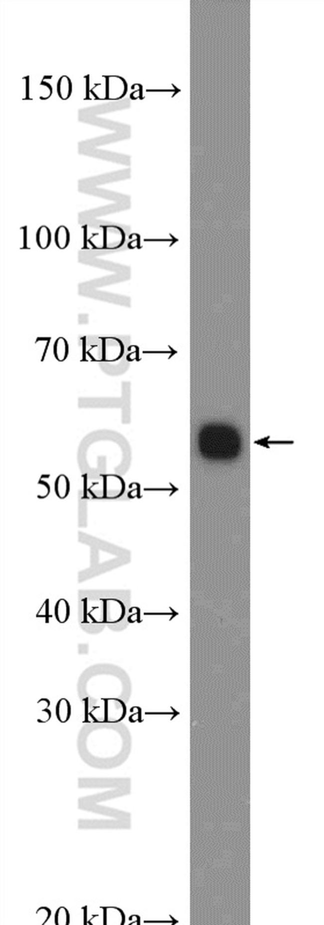 BMP5 Antibody in Western Blot (WB)