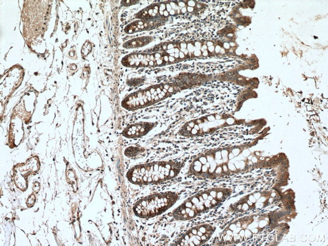 BMP5 Antibody in Immunohistochemistry (Paraffin) (IHC (P))