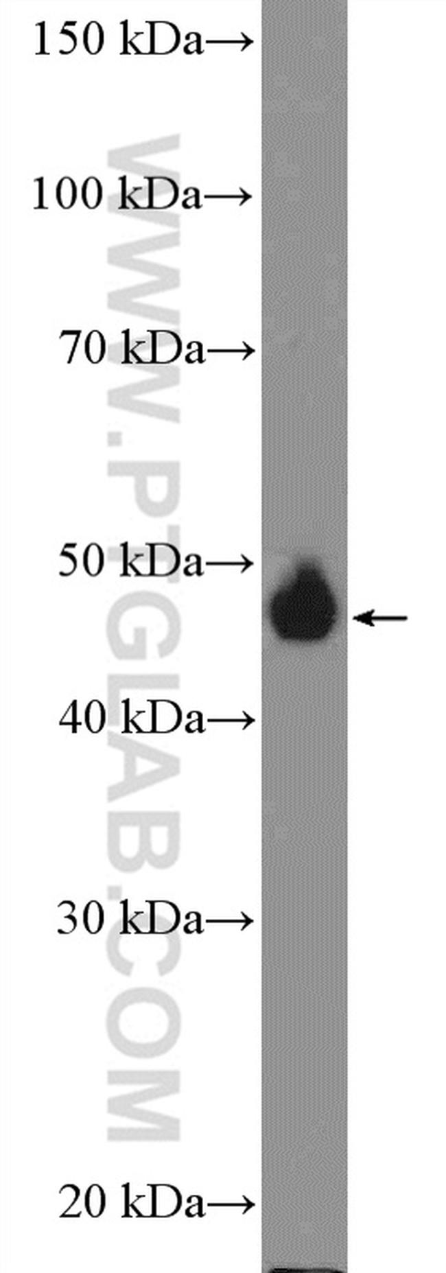 BMP5 Antibody in Western Blot (WB)