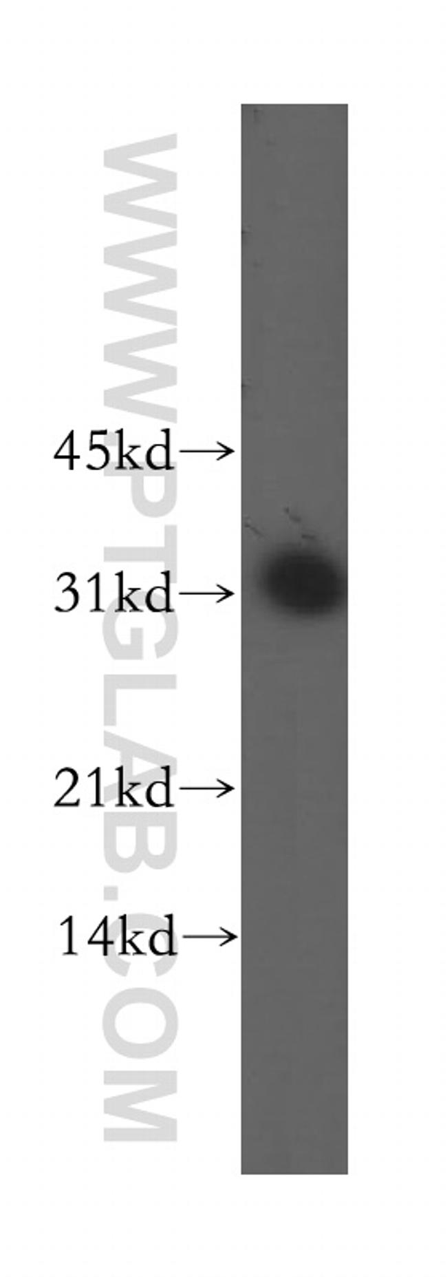 DLX3 Antibody in Western Blot (WB)