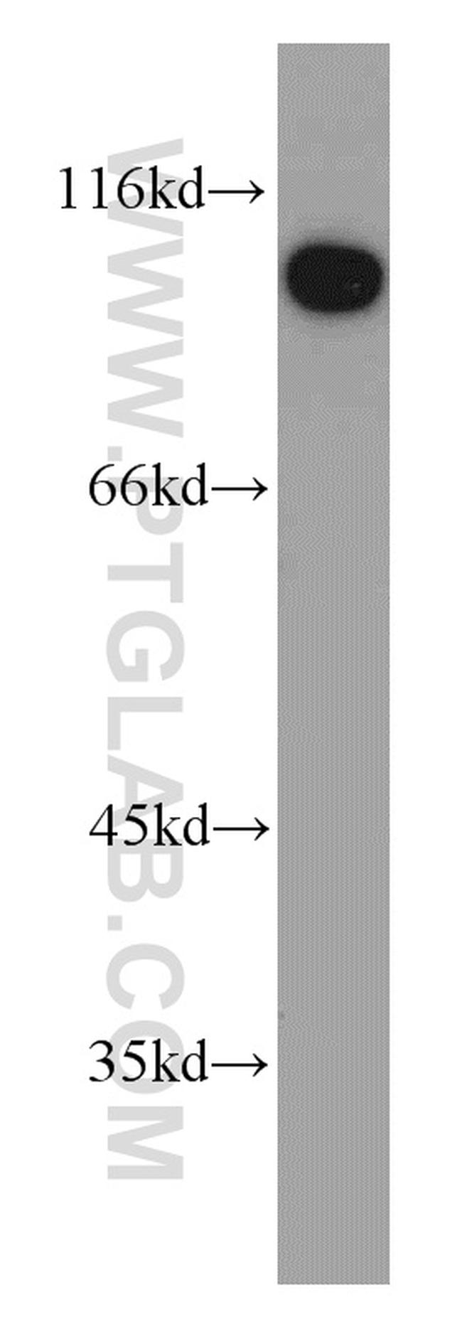 CTAGE1 Antibody in Western Blot (WB)