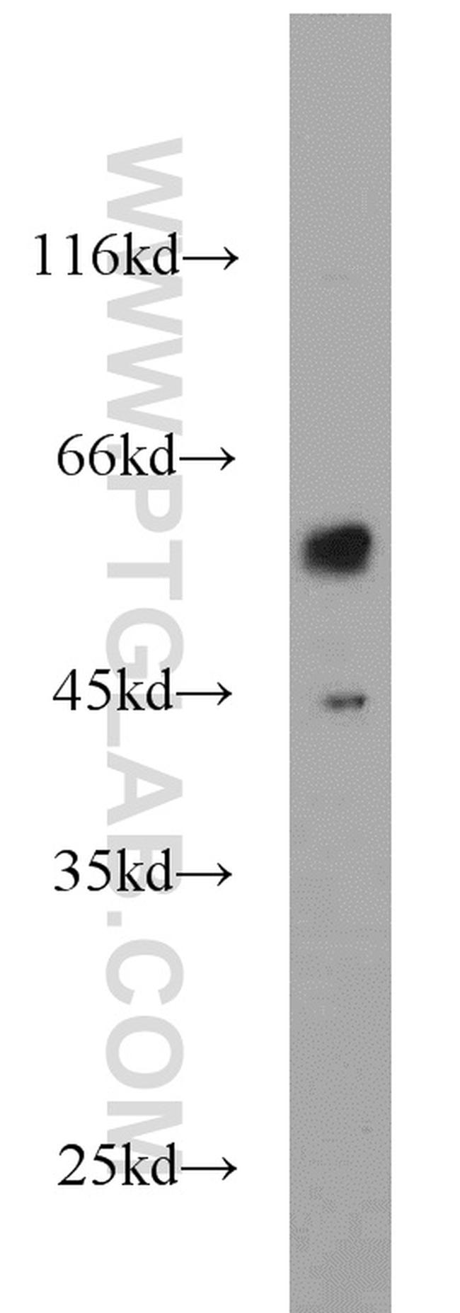 CPEB1 Antibody in Western Blot (WB)