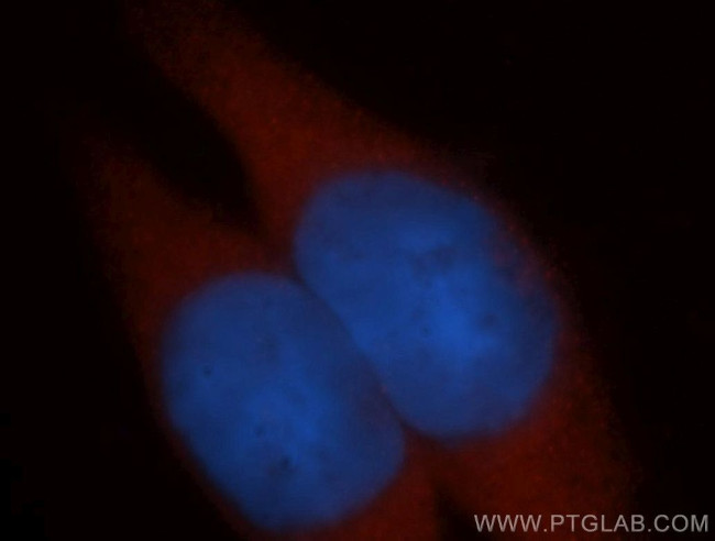 ADH6 Antibody in Immunocytochemistry (ICC/IF)