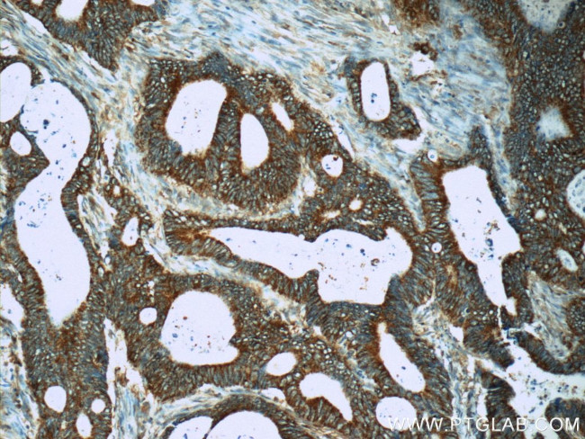 MS4A12 Antibody in Immunohistochemistry (Paraffin) (IHC (P))