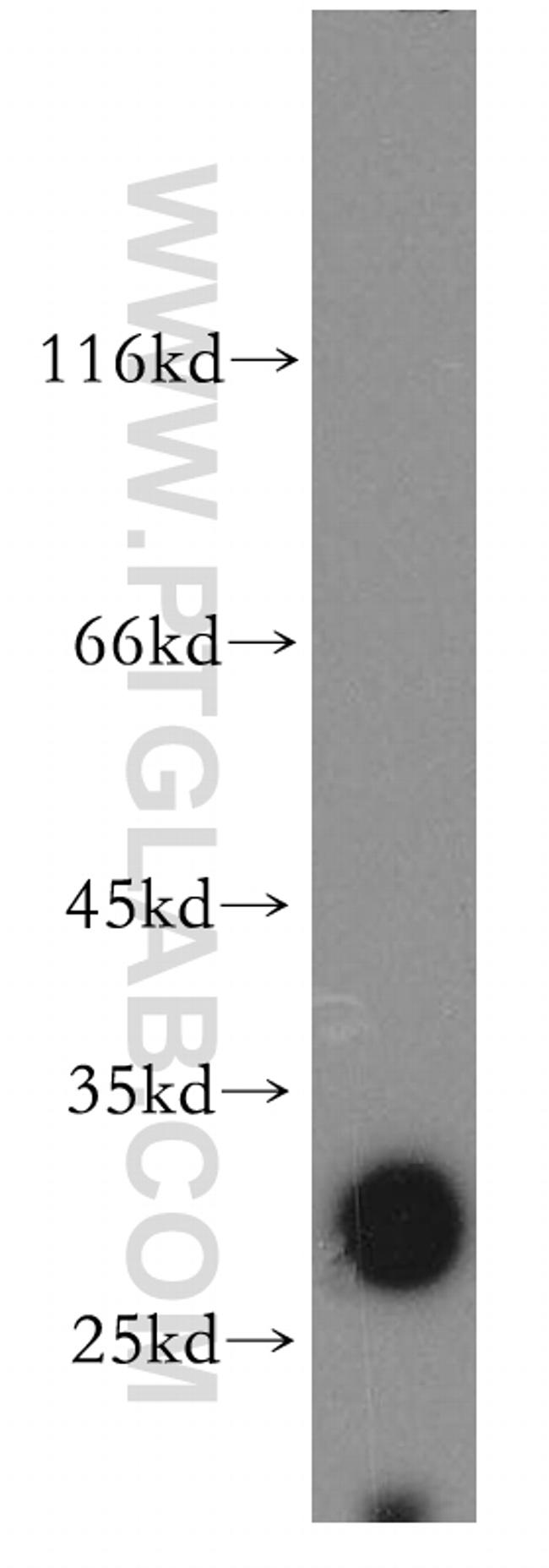 SLC17A5 Antibody in Western Blot (WB)