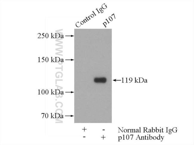 p107 Antibody in Immunoprecipitation (IP)