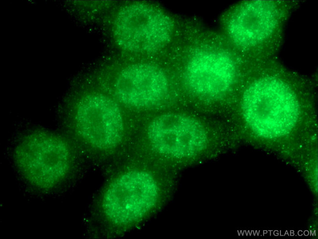 RAD17 Antibody in Immunocytochemistry (ICC/IF)