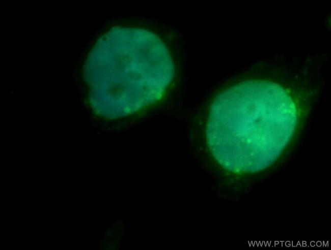 RAD17 Antibody in Immunocytochemistry (ICC/IF)