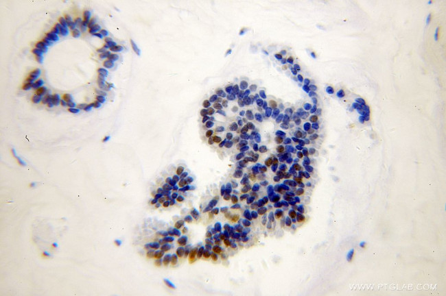 RAD17 Antibody in Immunohistochemistry (Paraffin) (IHC (P))