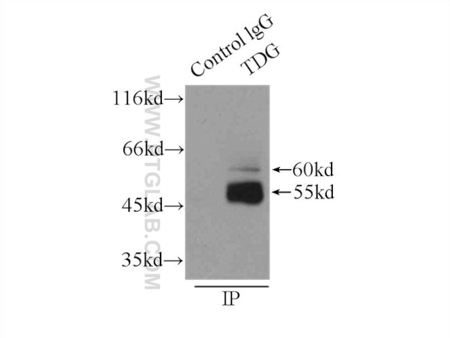 TDG Antibody in Immunoprecipitation (IP)