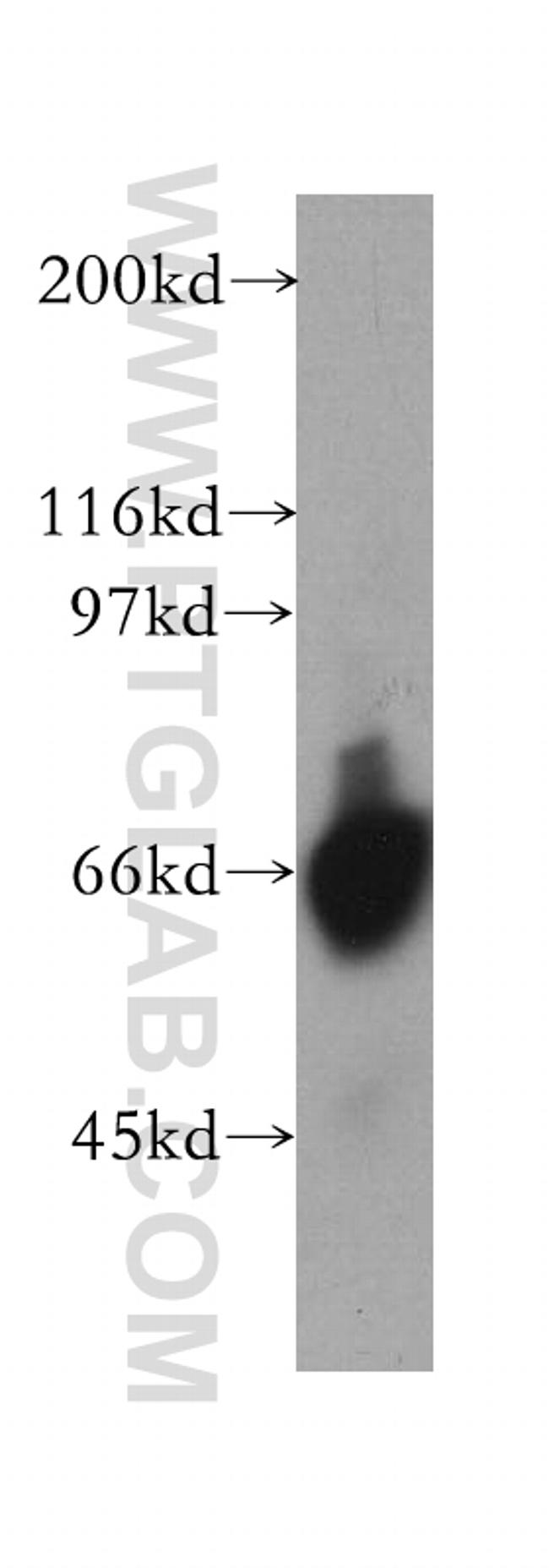 TDG Antibody in Western Blot (WB)