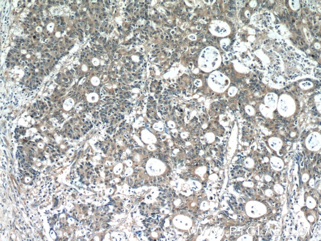 SCFD2 Antibody in Immunohistochemistry (Paraffin) (IHC (P))