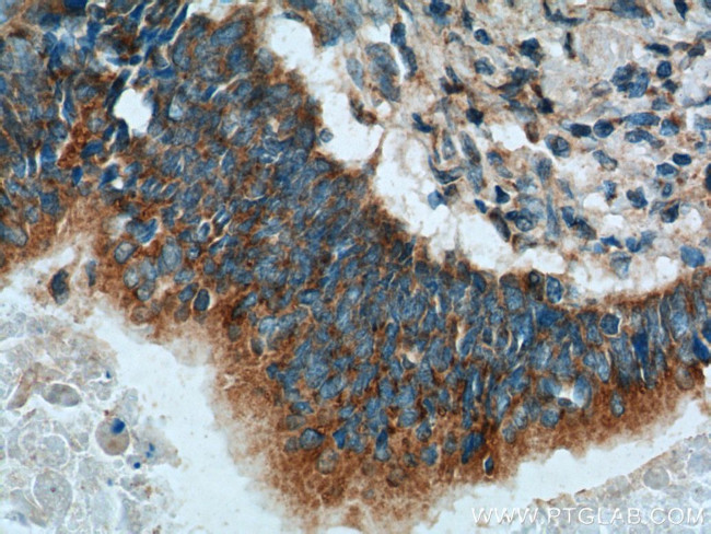 IHH Antibody in Immunohistochemistry (Paraffin) (IHC (P))