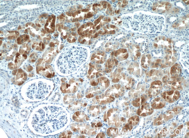 IHH Antibody in Immunohistochemistry (Paraffin) (IHC (P))